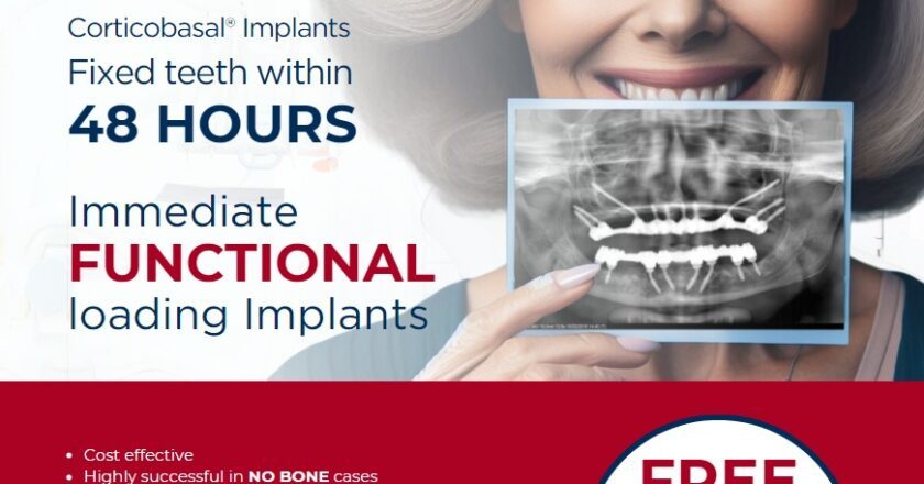 48 Hours to Happiness: Simpladent’s Breakthrough Dental Implant Solution Brings Smiles Back to All Age Patients