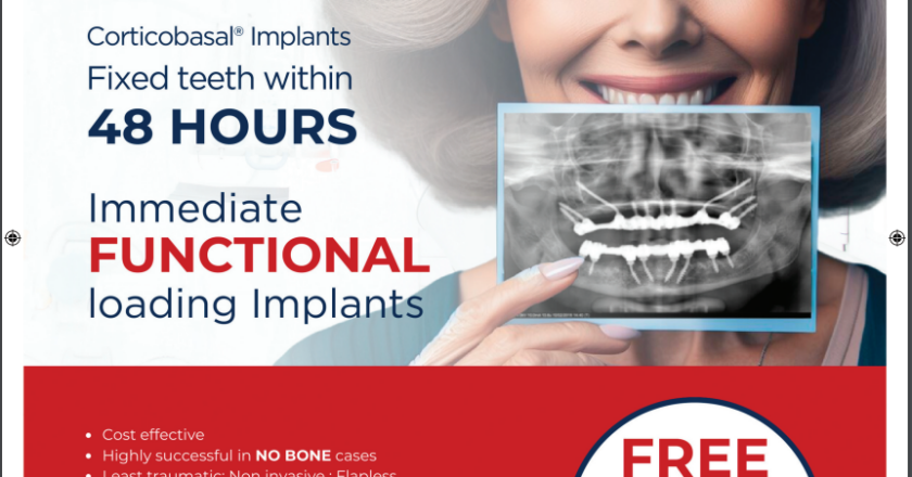 Say Goodbye to Waiting: Simpladent’s Immediate Loading Implants Offer Instant Results