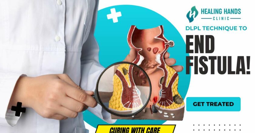 How to Cure Fistula Permanently?- DLPL Fistula Treatment 