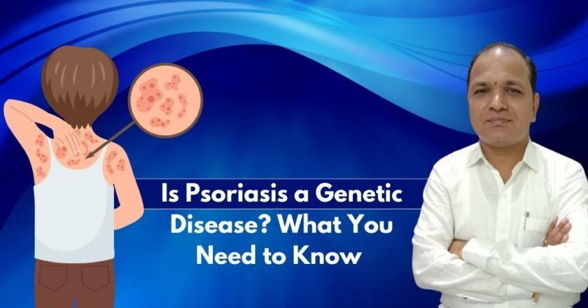 Is Psoriasis a Genetic Disease? What You Need to Know