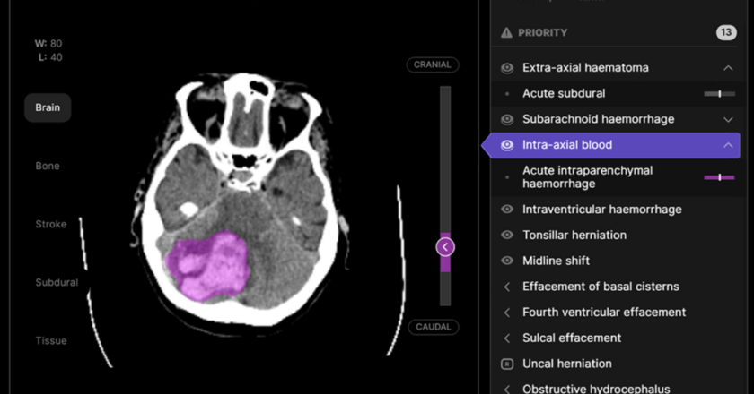 Aarthi Scans adopts Australian AI technology to elevate patient care management